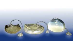 expansor de mama temporário